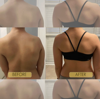 Instant Posture Corrector
